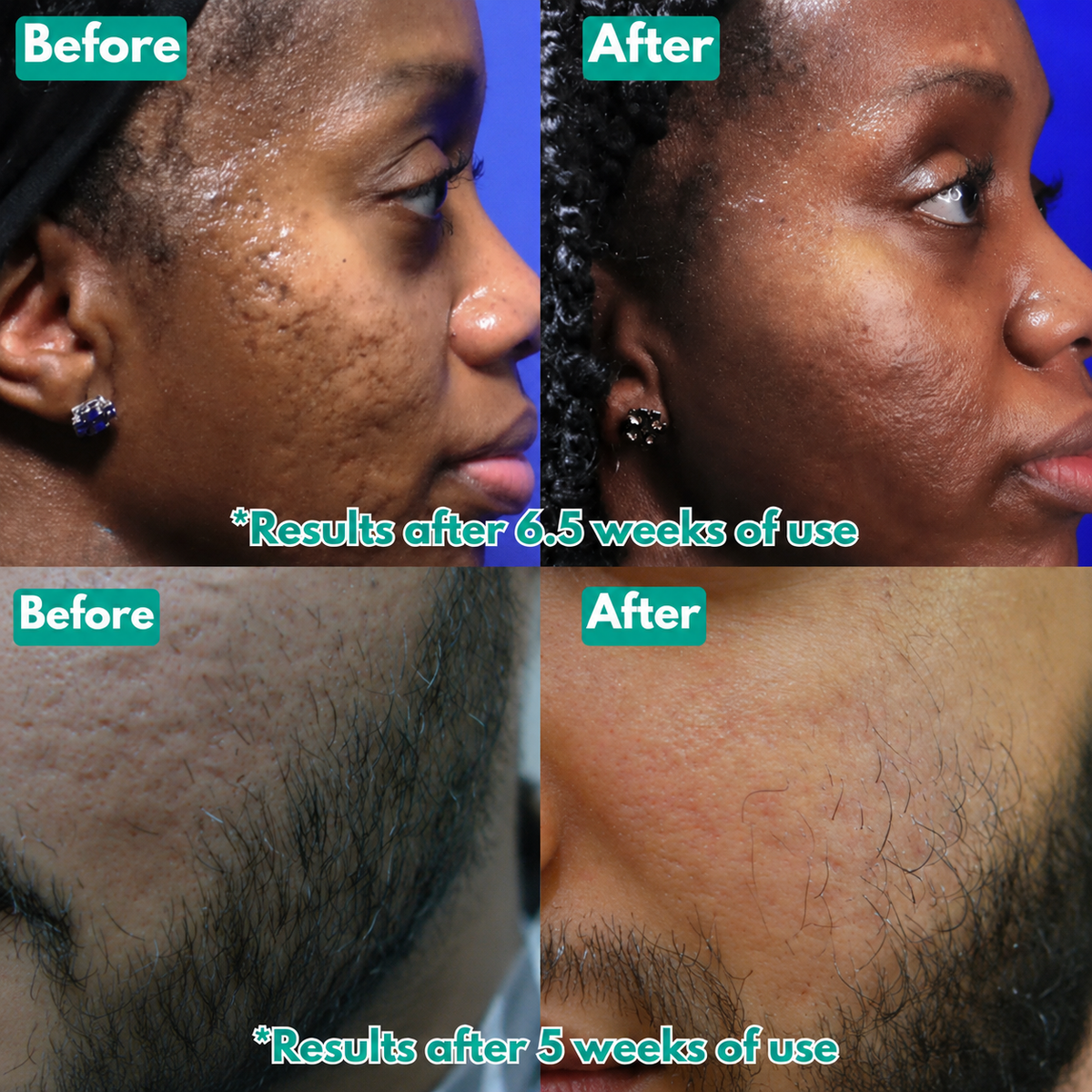 Clarivelle™ MicroCrystal Repair Serum