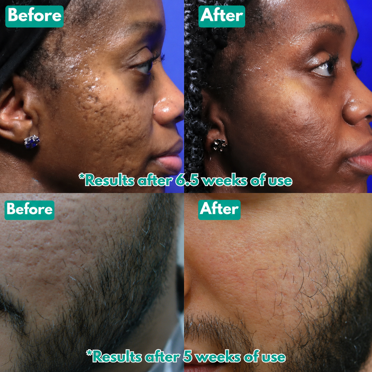 Clarivelle™ MicroCrystal Repair Serum