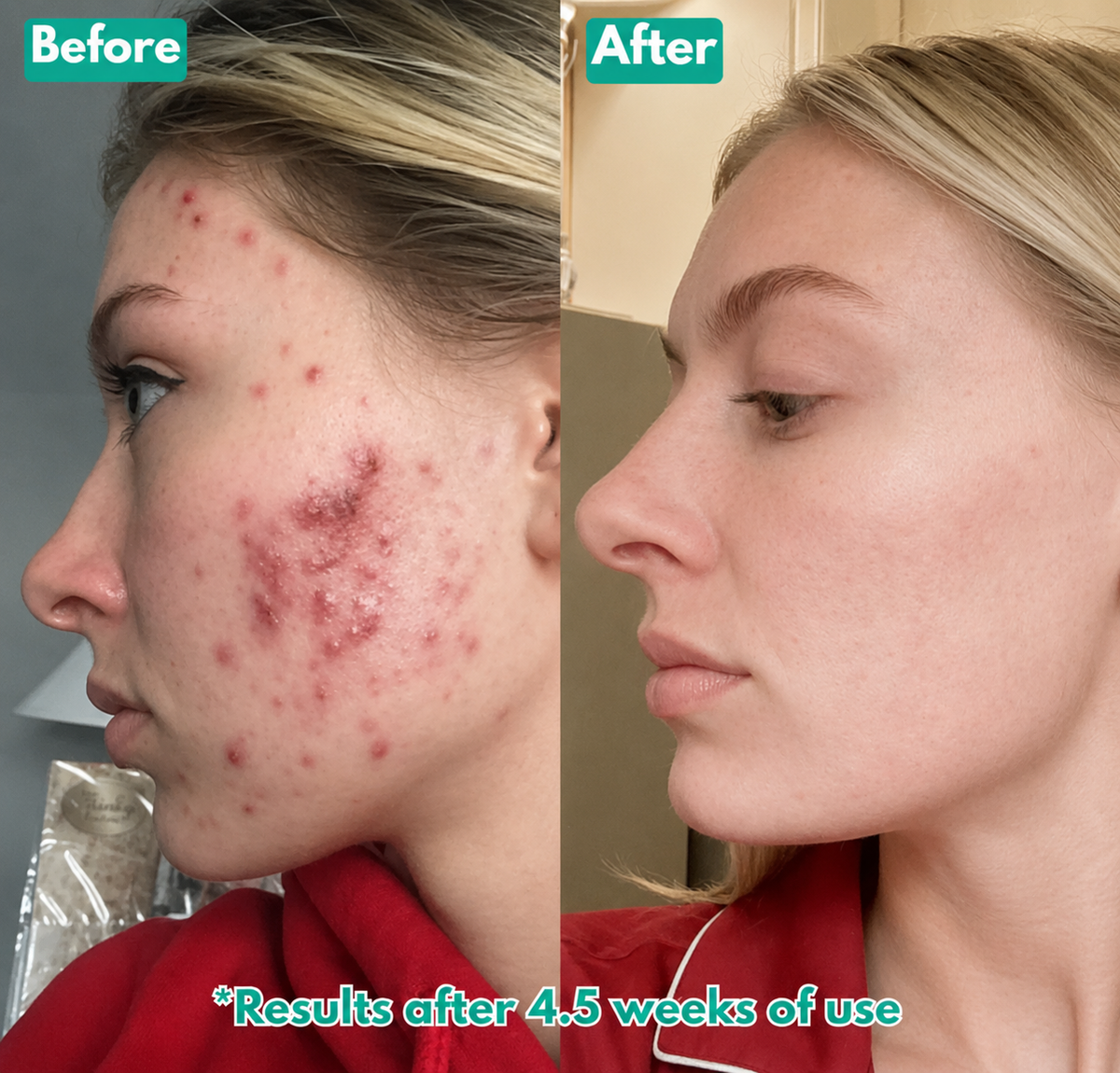 Clarivelle™ MicroCrystal Repair Serum